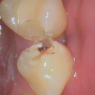 leczenie_78_524.JPG
